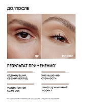 ICON SKIN Крем-гель для кожи вокруг глаз от отеков / Eyes Yoga 20 мл, фото 3